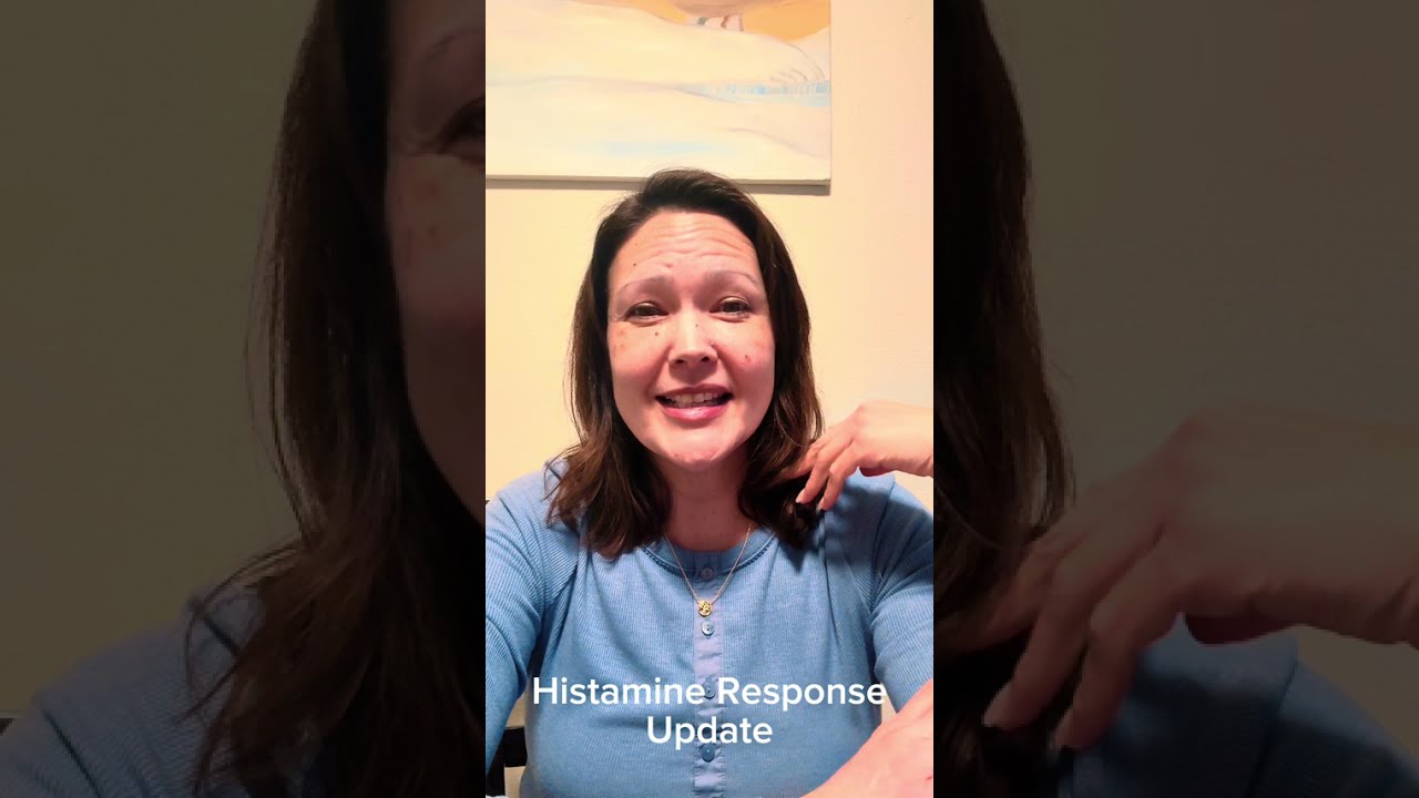 Histamine Response Update
