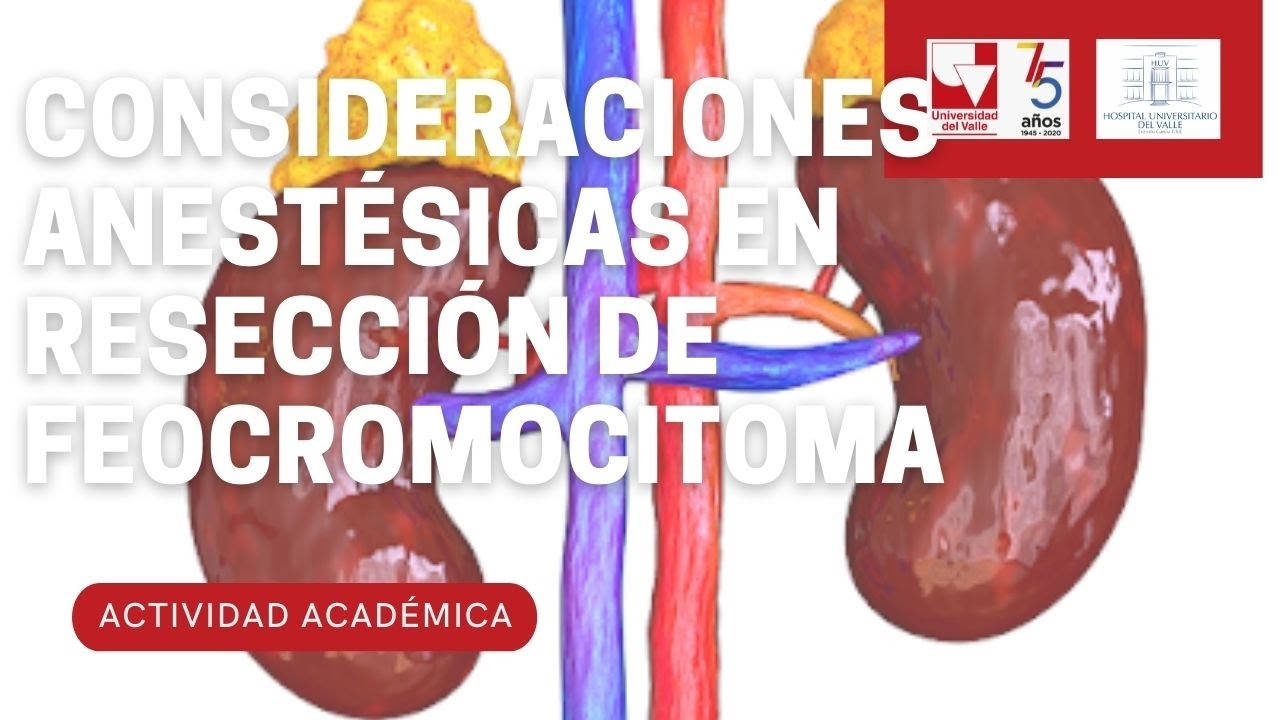 Consideraciones Anestésicas en Resección de Feocromocitoma