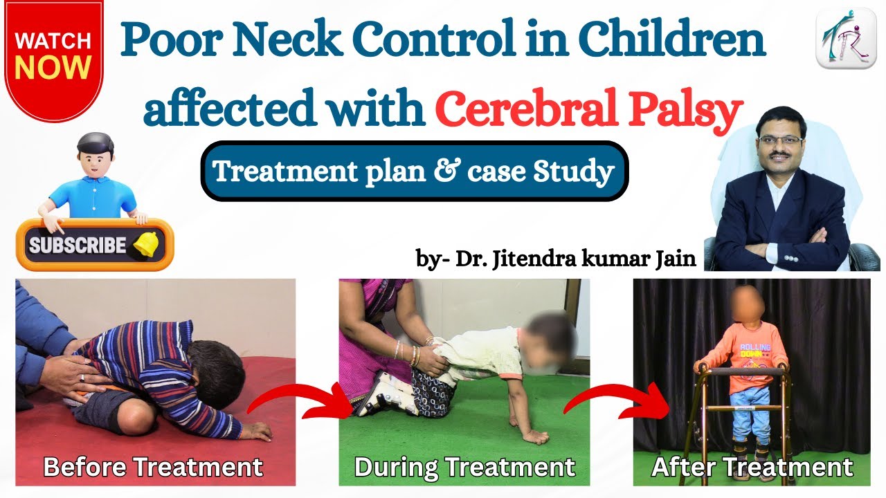 How to Deal with Poor Neck Control In Cerebral Palsy & Explore Few Examples - Trishla Foundation
