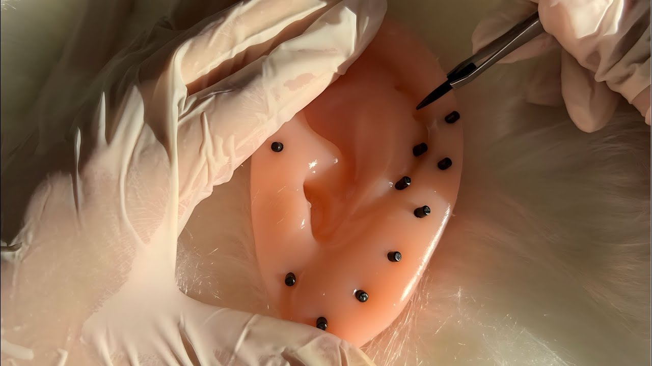 ASMR: EXTRAÇÃO DE CRAVOS DO OUVIDO | DURMA EM 5 MINUTOS