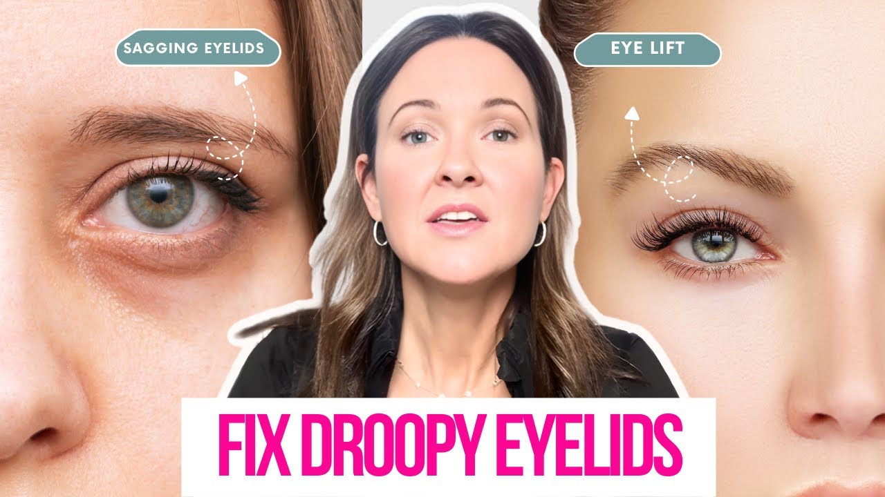 Minimally Invasive Treatments Can Fix Droopy Eyelids and Sagging Skin