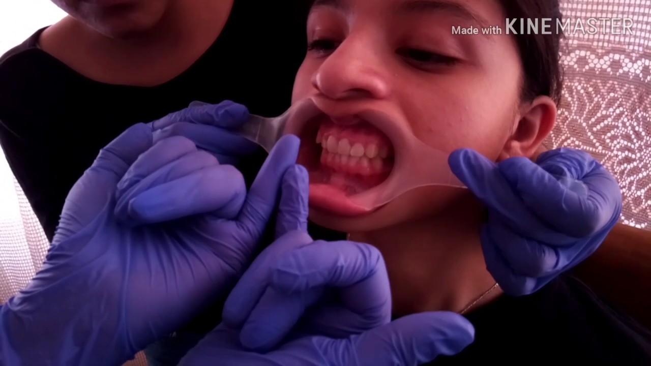 FOTOGRAFÍA DENTAL