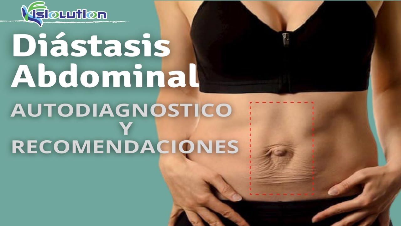 DIÁSTASIS ABDOMINAL | AUTODIAGNÓSTICO y RECOMENDACIONES | Fisiolution