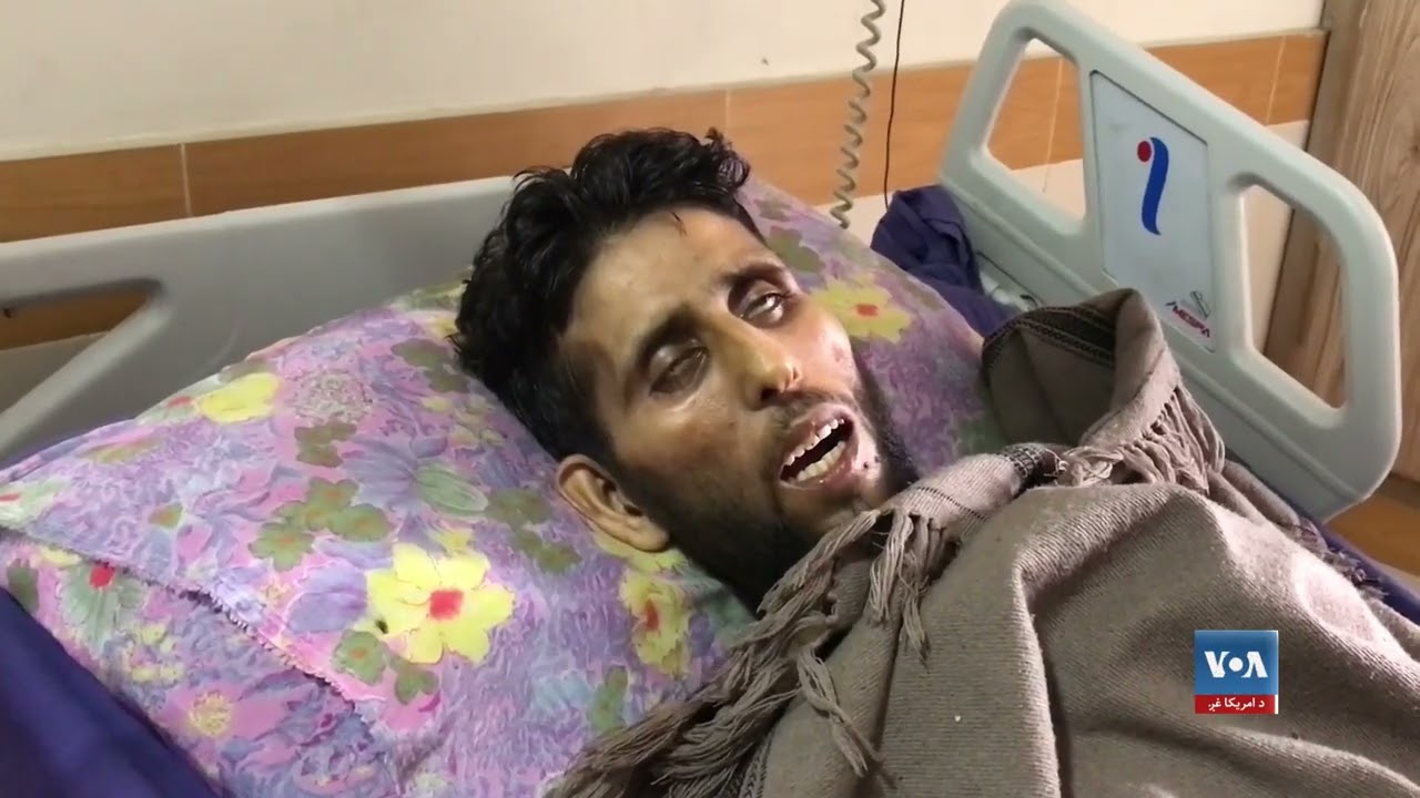 نړۍ کې د تور زیړي پر ضد د مبارزې نړیواله ورځ