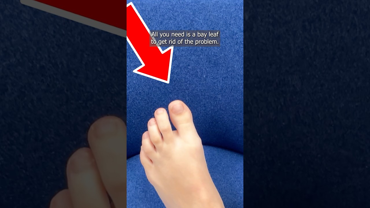 I Got Rid of Nail Fungus Naturally &ndash; It Disappeared Instantly!