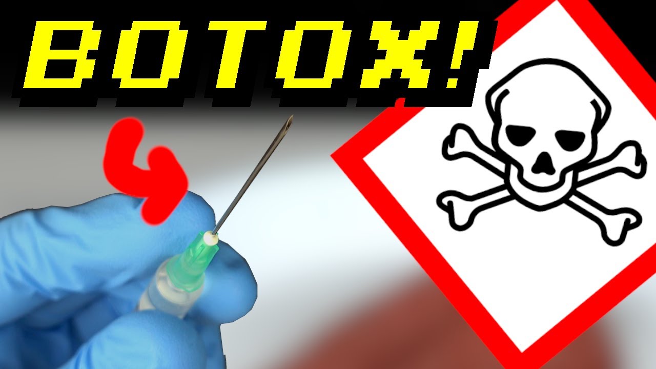 Die giftigste Substanz der Welt! Botox