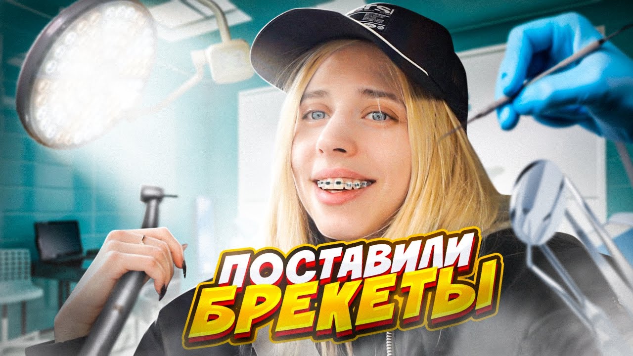 Мне поставили БРЕКЕТЫ // ЖИЗА С КОШ