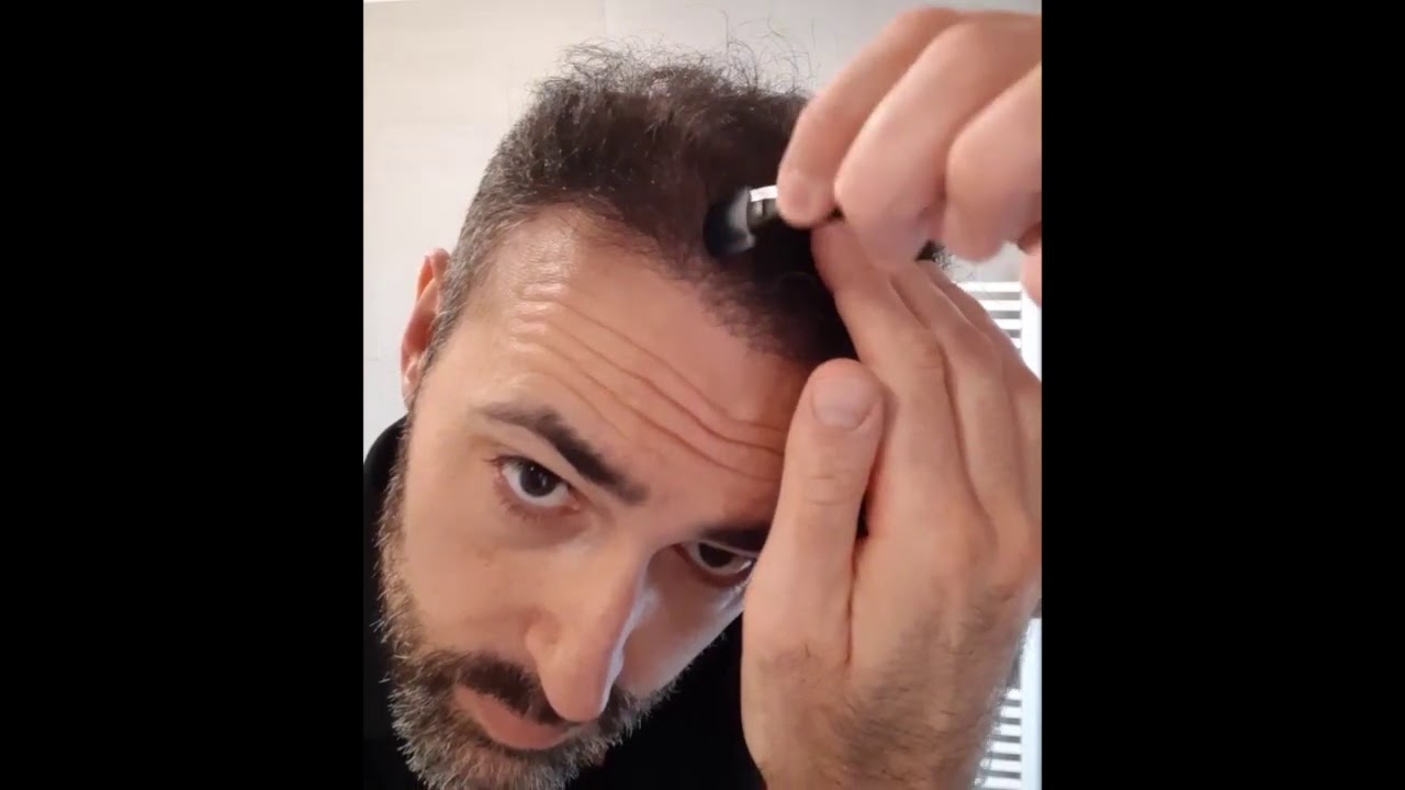 Marco - How to use Kmax Concealing Scalp Shader