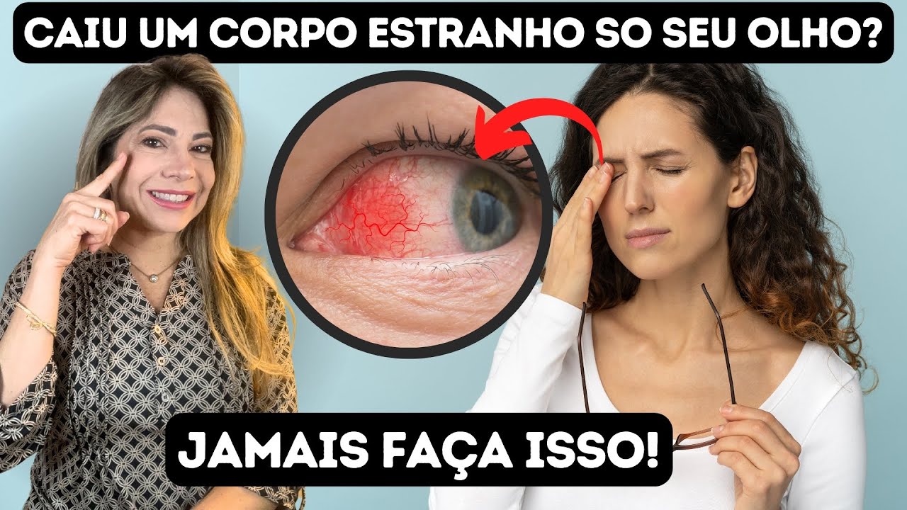 Cisco no Olho: O Que Fazer e Quando Procurar um Oftalmologista?
