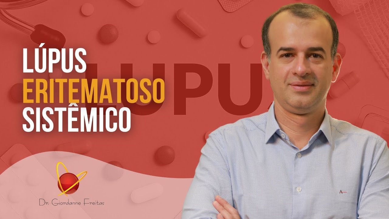 Aula completa sobre Lúpus Eritematoso Sistêmico | Dr. Giordanne Freitas