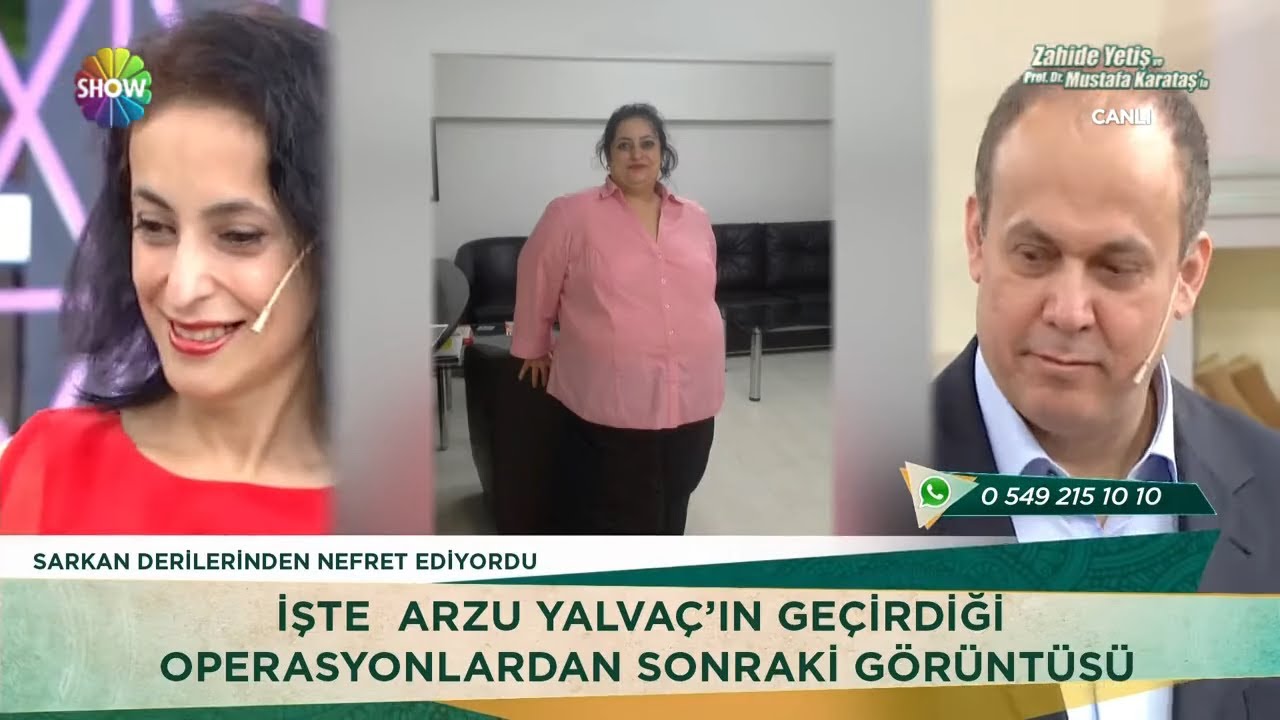 94 kilo veren Arzu Hanım'ın şaşırtan değişimi!