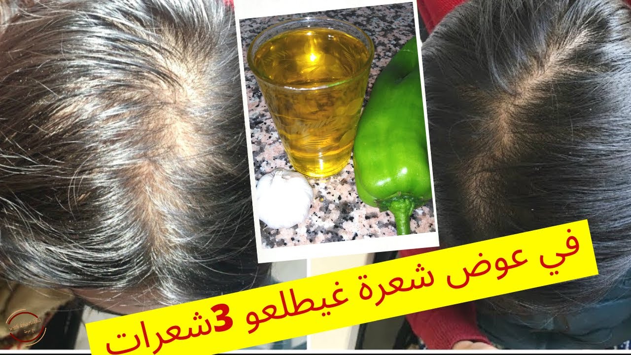 طريقة صحيحة لتحضير زيت الفلفةالمعجزة في تطويل منع تساقط وتنبيت شعر من اول استعمال جربي واحكمي بنفسك