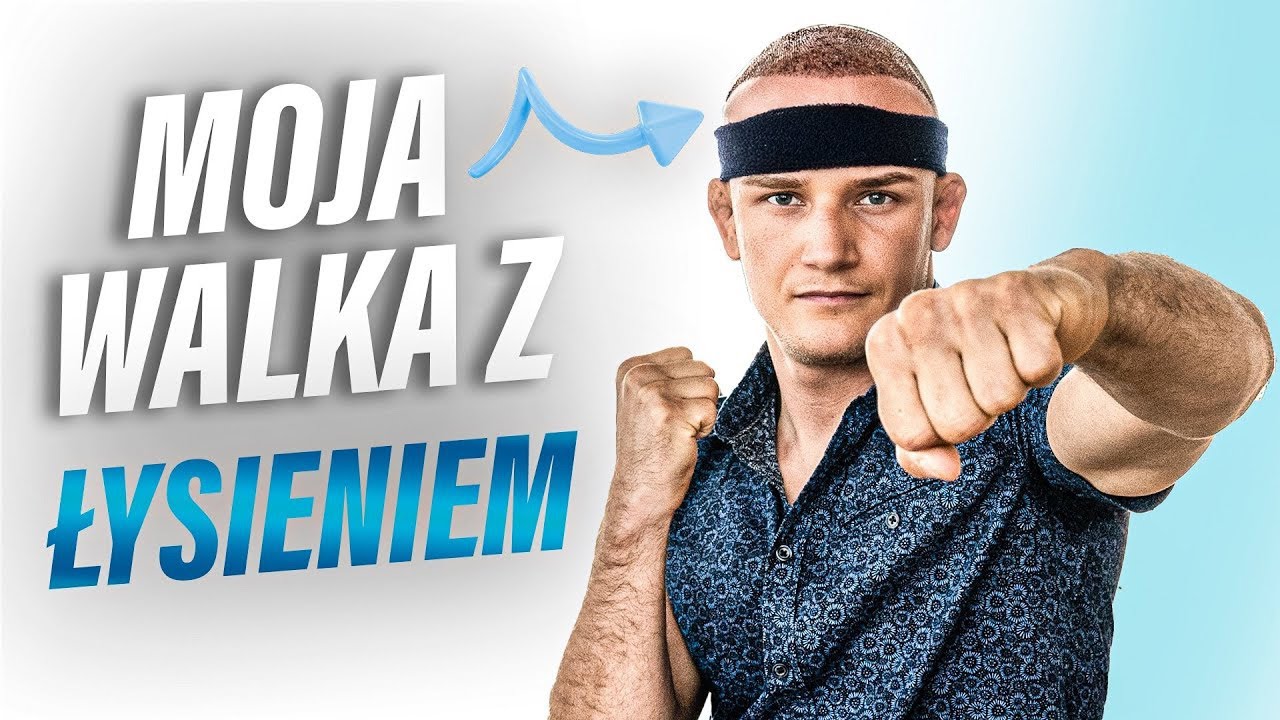 Mój Przeszczep Włosów w Turcji od A do Z