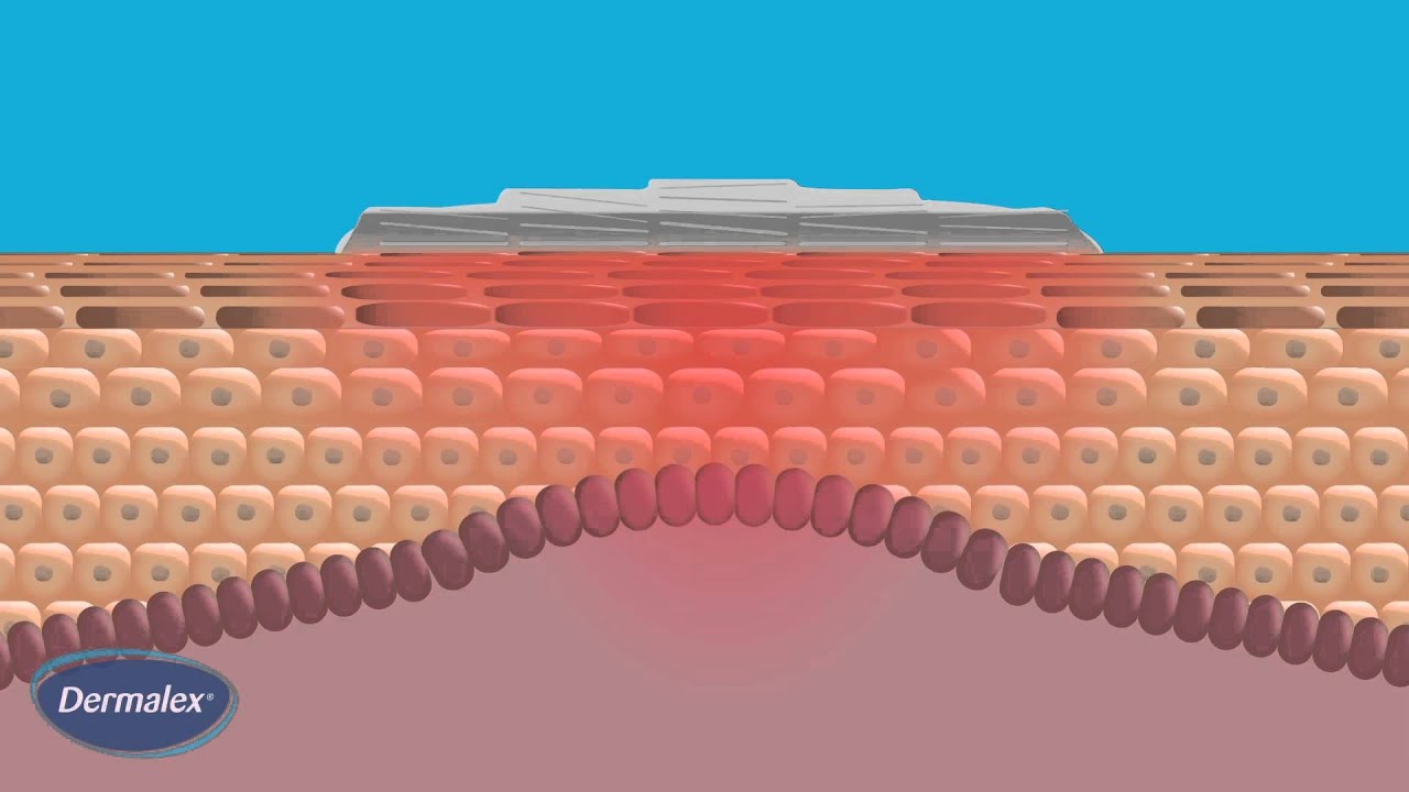 Dermalex Psoriasis - How it works