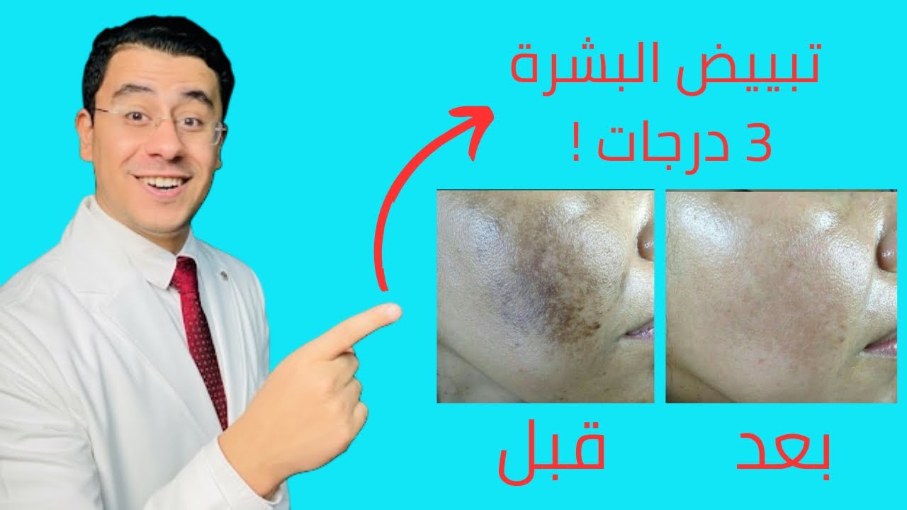 اقوى وصفة طبيعية هتبيض بشرتك ٣ درجات 