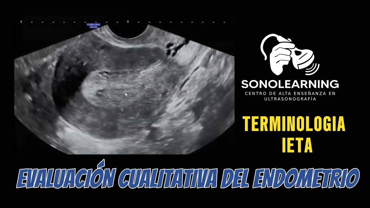 EVALUACION CUALITATIVA DEL ENDOMETRIO - TERMINOLOGIA IETA