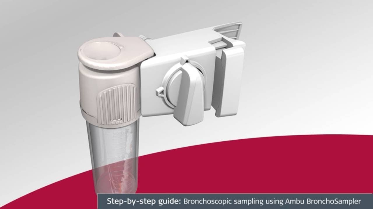 Step-by-step guide: Bronchoscopic sampling using Ambu BronchoSampler