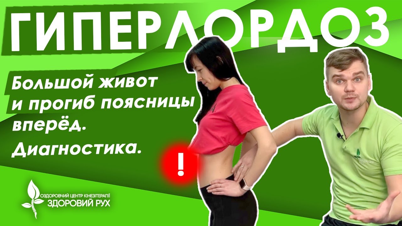 Большой живот и прогиб поясницы вперёд. Почему качание пресса не помогает | КИНЕЗИТЕРАПИЯ