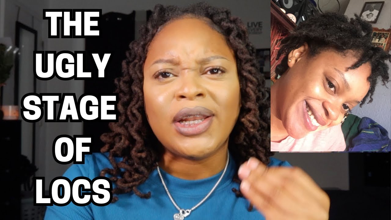 Surviving The Ugly Stage Of Locs : My Truth & Tips