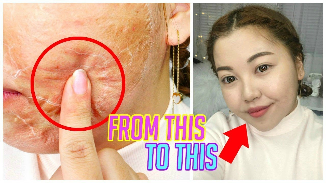 The MOST NATURAL Cushion for ACNE SKIN I've EVER TRIED!