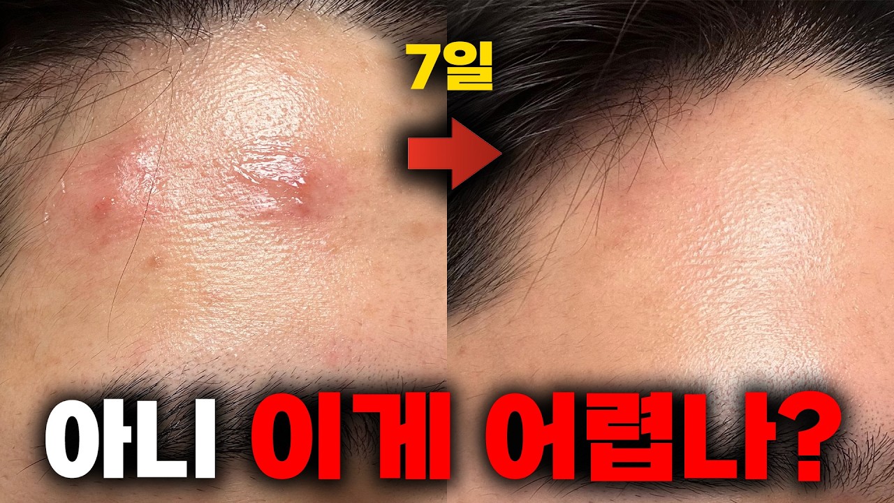 피부 타입별로 딱 이것만 고치세요 (단기간에 확 바뀜)