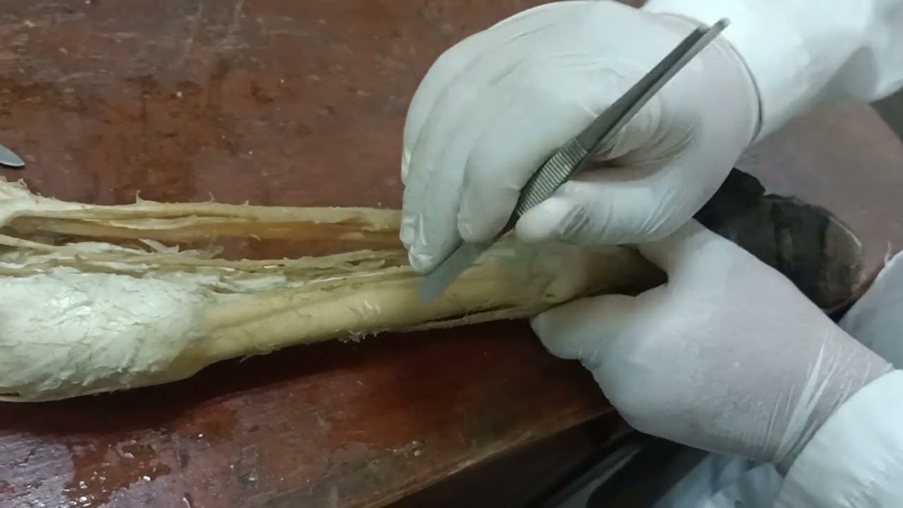 Muscles of forearm extensors and flexors دكتور رمضان ساري