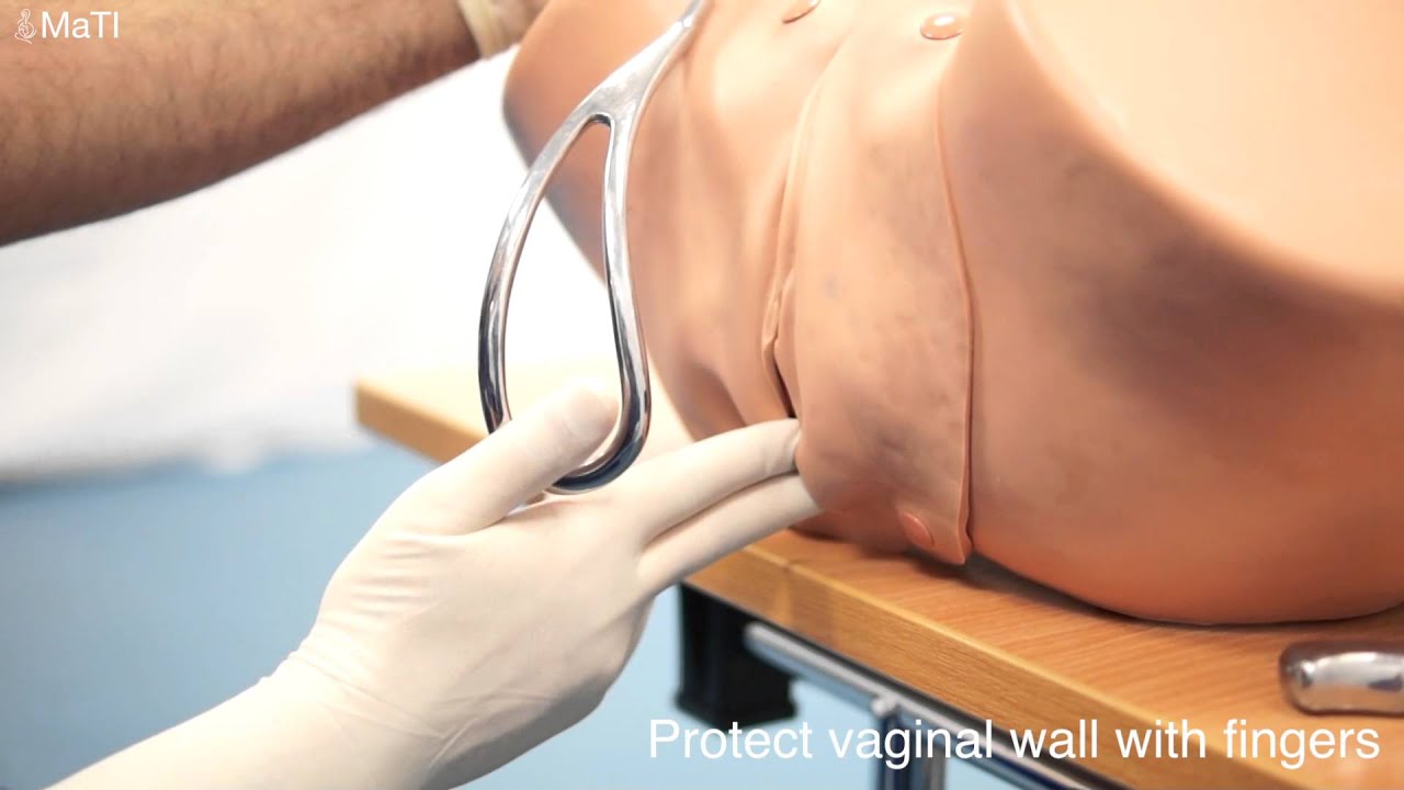 Forceps delivery demonstration
