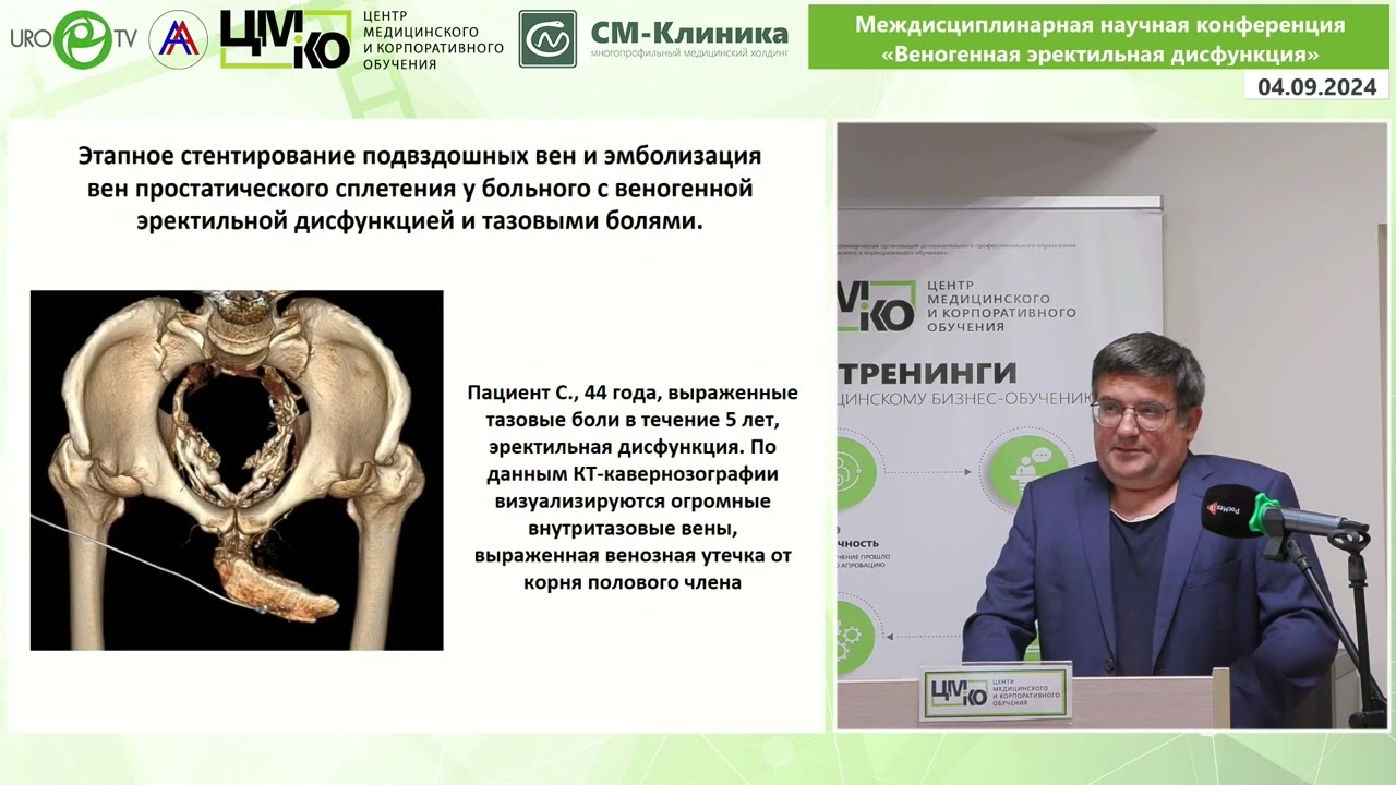 Панков А.С. Комбинированные рентгенохирургические операции в лечении пациентов с веногенной ЭД.