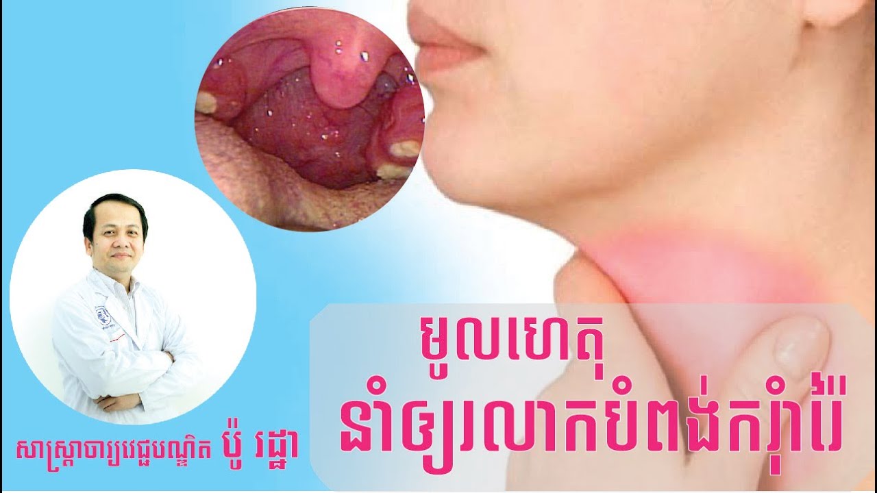 យល់ដឹងអំពីជំងឺរលាកបំពង់ករុំារ៉ៃ