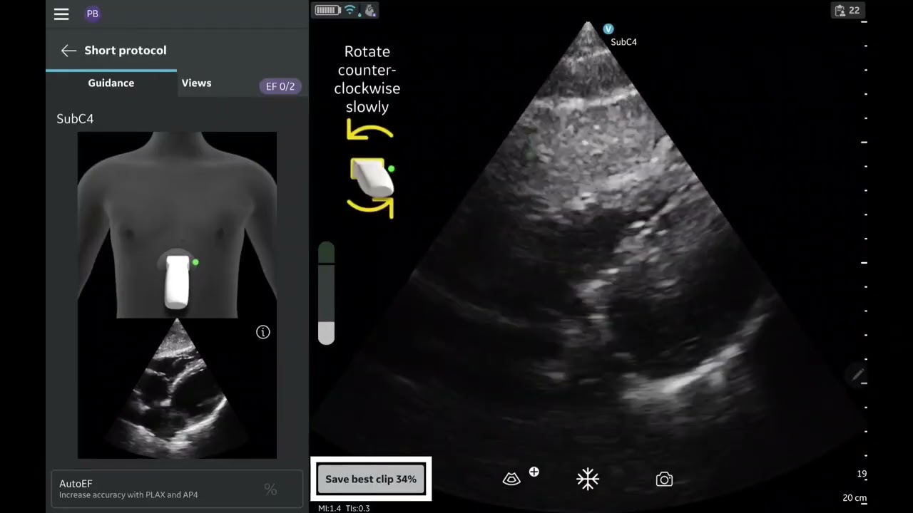 Vscan Air™ Product Tutorial | Caption AI™