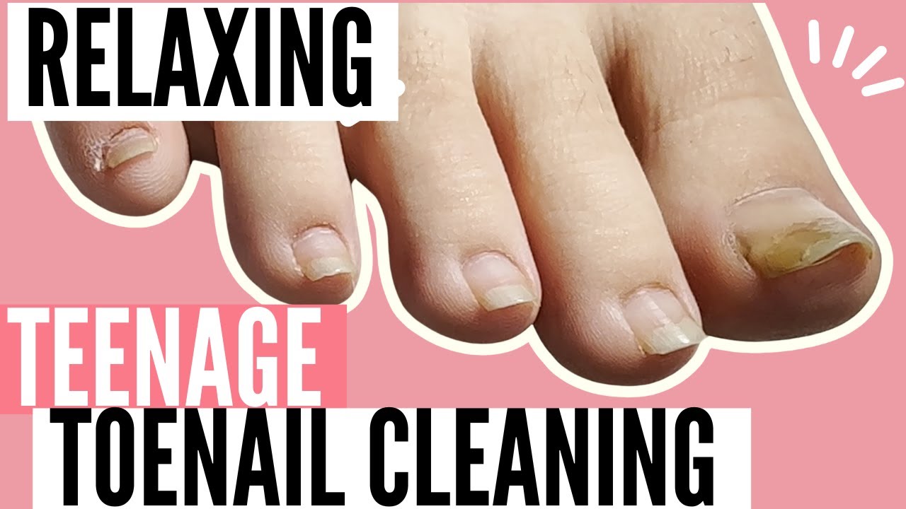Relaxing Toenail Cleaning Pedicure No Talking