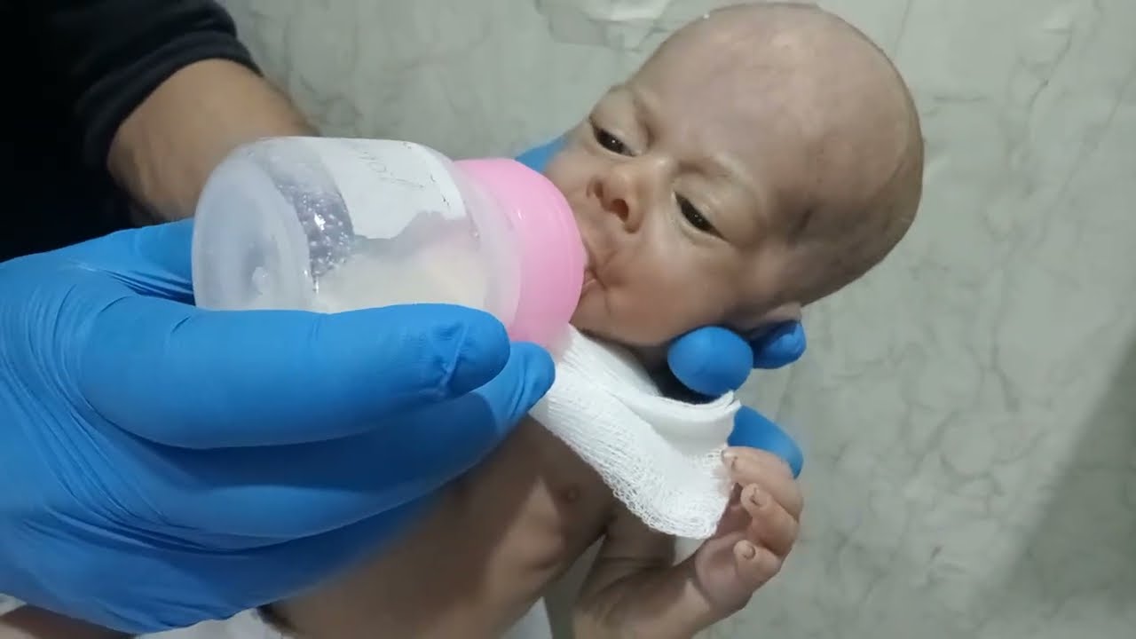 Newborn Baby Feeding Trial & Sepsis Assessment | FDA Diagnosis in NICU | Critical Neonatal Care