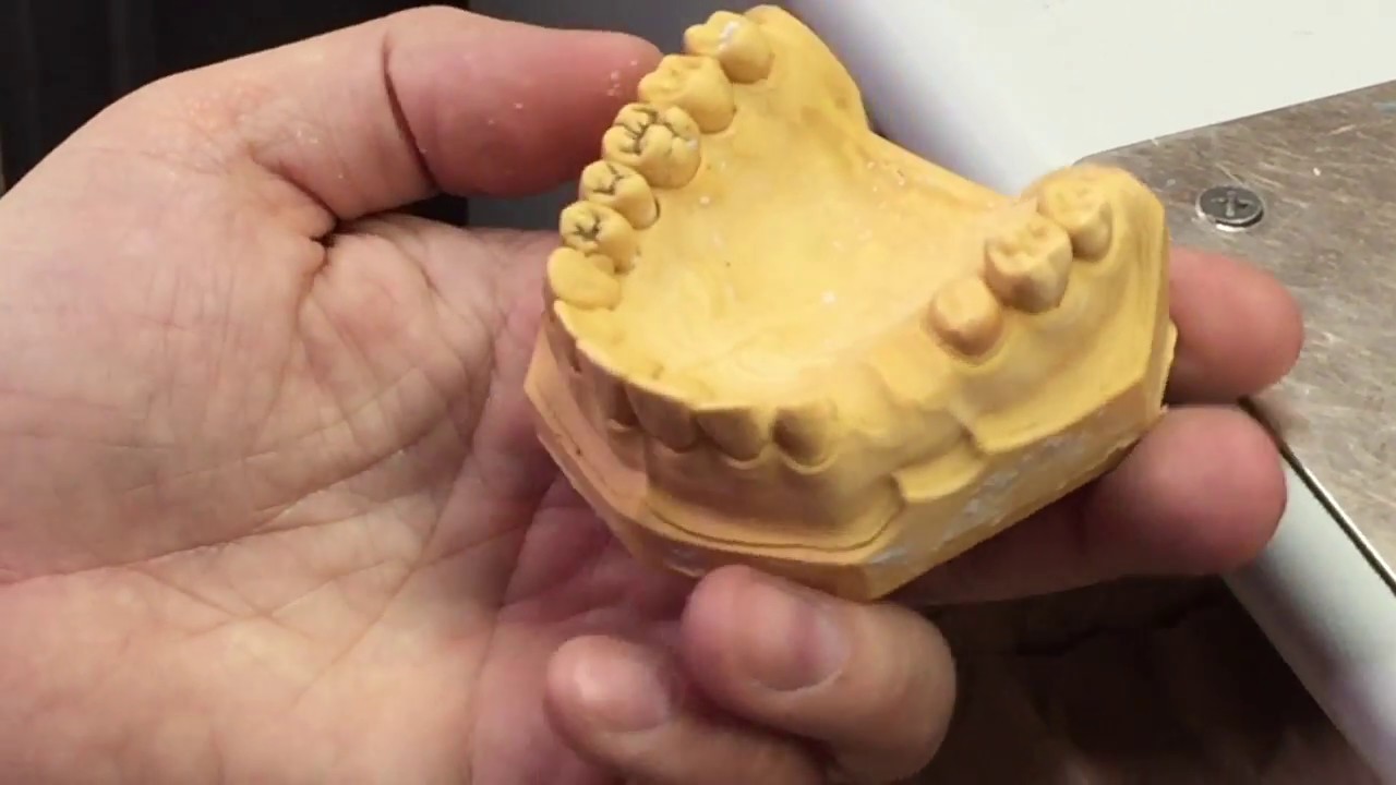 Elaboración de piezas provisionales en acrílico