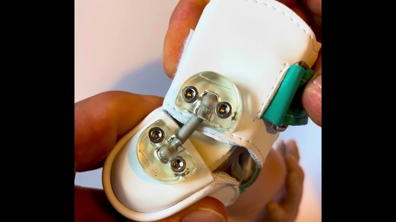 Bebax Fu&szlig;redressionsorthese  von Basko Sichelfu&szlig; Kinder Orthese Orthop&auml;dietechnik
