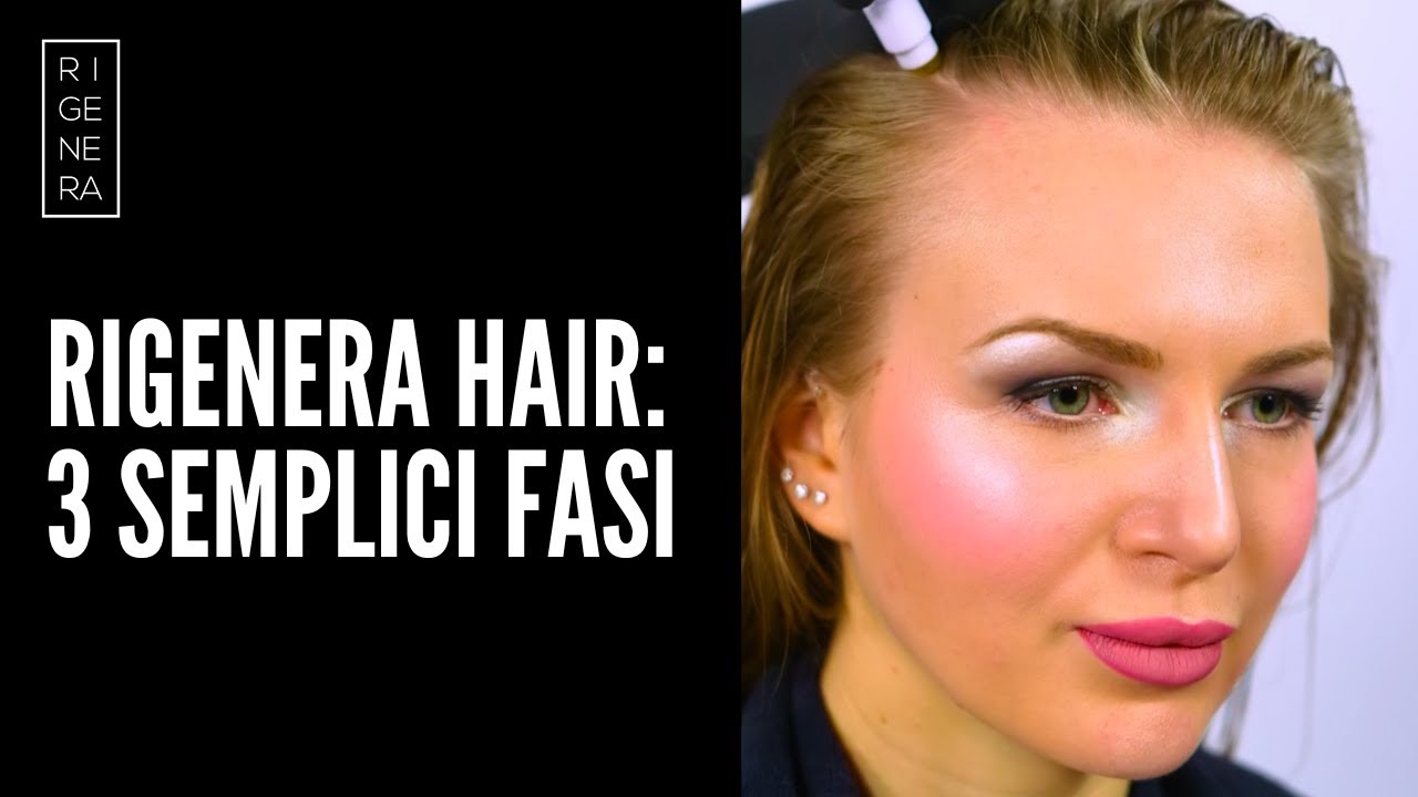 RIGENERA HAIR: rivitalizza i tuoi capelli e scopri le 3 semplici fasi del trattamento microneedling