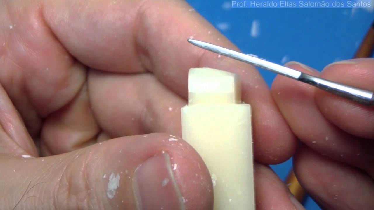 Segundo Molar Superior