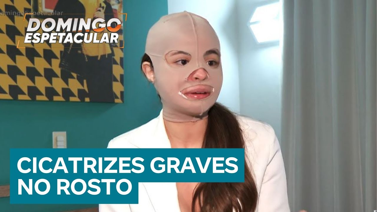 Pacientes sofrem queimaduras após peeling feito por dentista