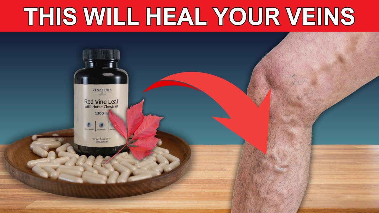 Unleash the Power of Red Vine Leaf: Tackle Varicose Veins Naturally