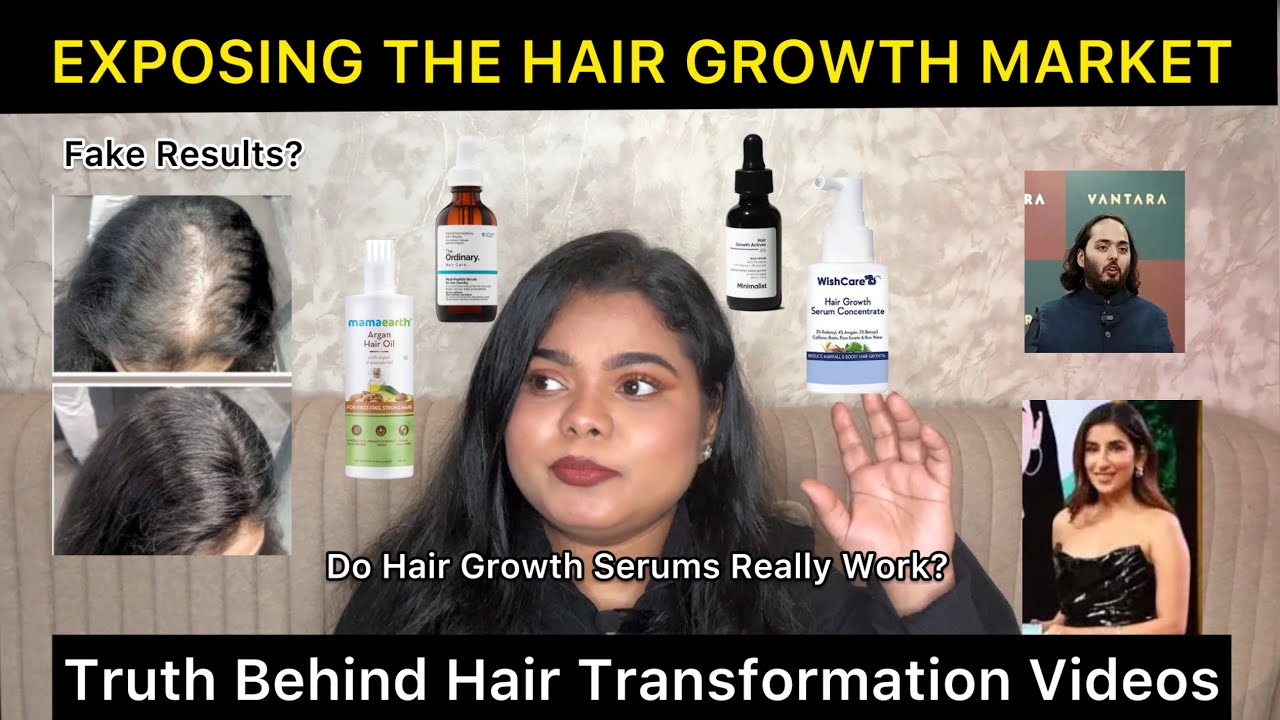 I tried all the VIRAL HAIR serums… & here is the TRUTH they don’t want you to know | Hair Growth 