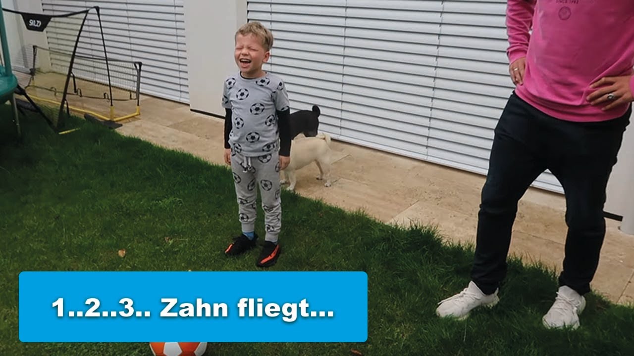 Wir schießen Dion‘s ersten Wackelzahn raus - Klappt alles?!