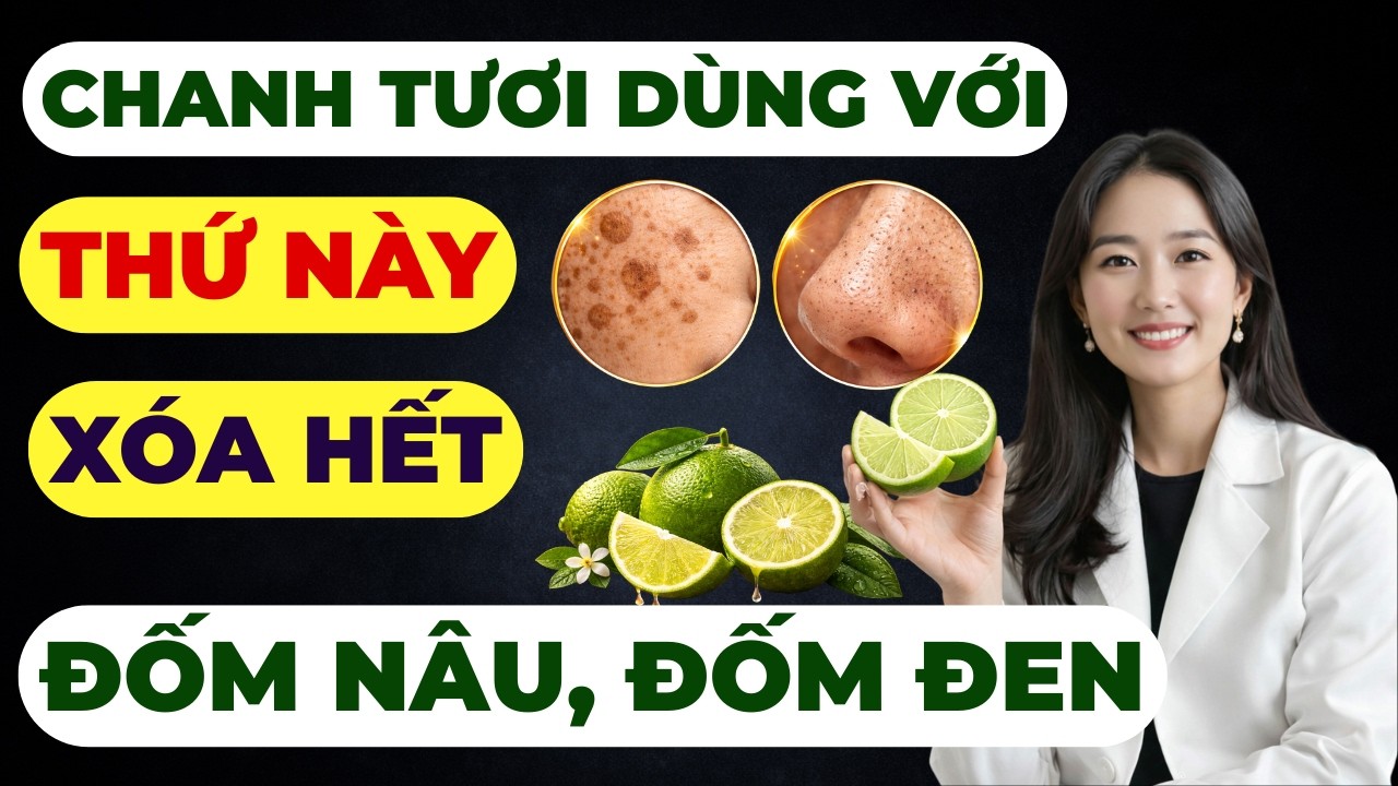 Bác Sĩ Hướng Dẫn Các Công Thức Dùng Với Quả Chanh Tươi | Xóa Hết Đốm Nâu Đốm Đen Trên Da Mặt Tại Nhà