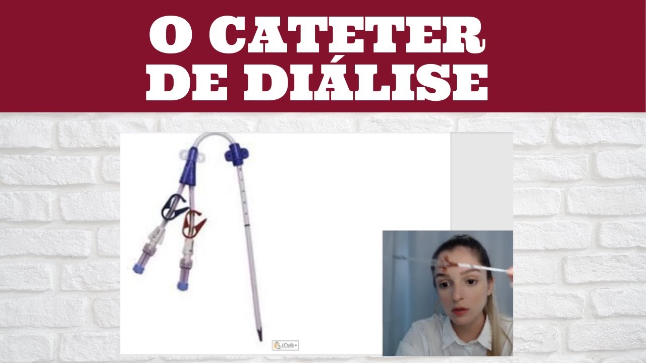 COMO ENTENDER O CATETER DE DIÁLISE?