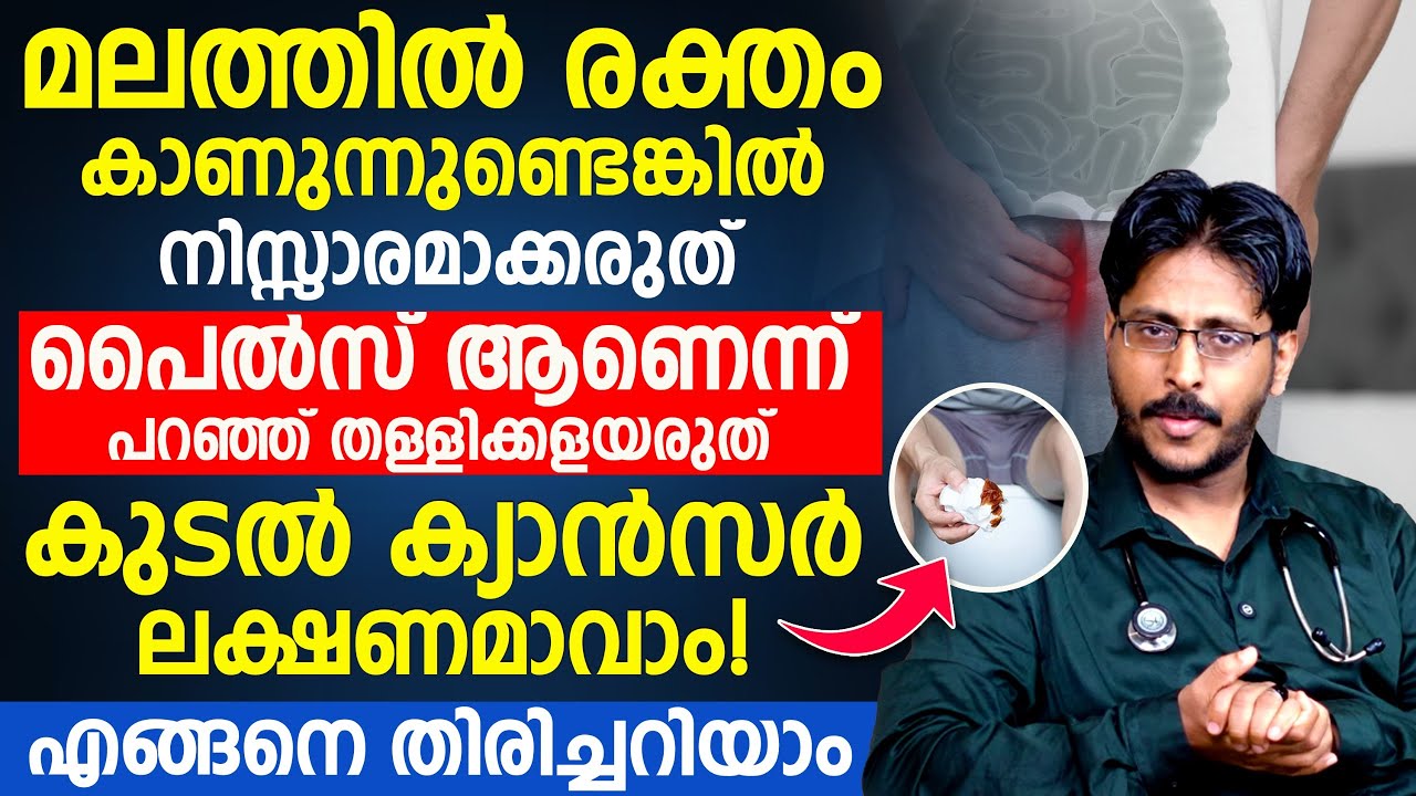 മലത്തിൽ രക്തം കാണുന്നുണ്ടോ ?  പൈൽസ് ആണെന്ന് പറഞ്ഞ് നിസ്സാരമായി തള്ളിക്കളയരുത്  Dr. Muhammed Aslam M