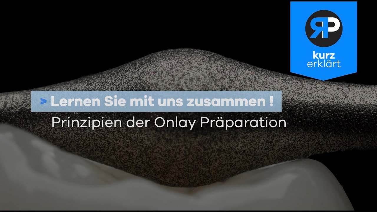 Teilkronen (Onlay) Pr&auml;paration // Kurz erkl&auml;rt