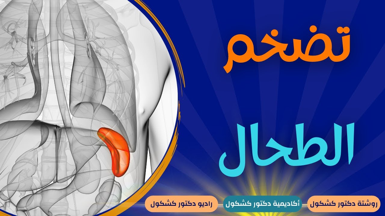 تضخم الطحال: الأسباب، الأعراض، هل هو خطير؟ وكيفية العلاج!