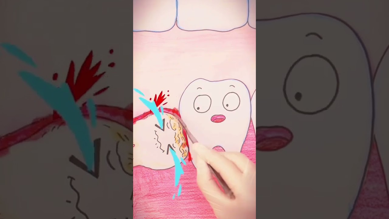 Aql tish hayoti haqida 🦷😁#funny #foydali #viral #shotrs #video