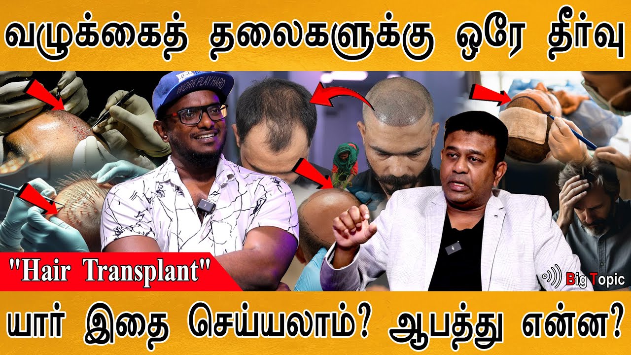🧑‍🦲வழுக்கை தலையில் முடி வளரும் அதிசயம் | Hair Transplant | யார் செய்யலாம்? ஆபத்து என்ன? | Dr Vaasan