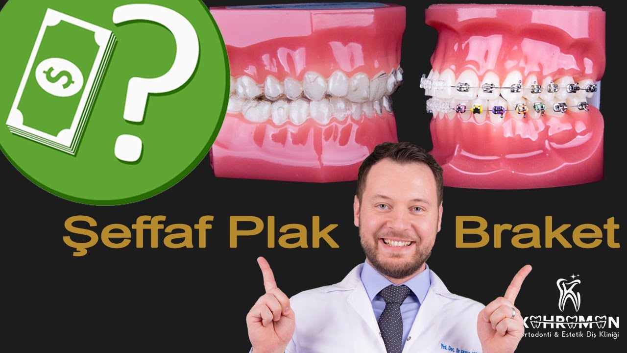 Fiyat Karşılaştırması: Invisalign Şeffaf Plak Tedavisi vs Diş Teli ( Braket ) ile Ortodontik Tedavi