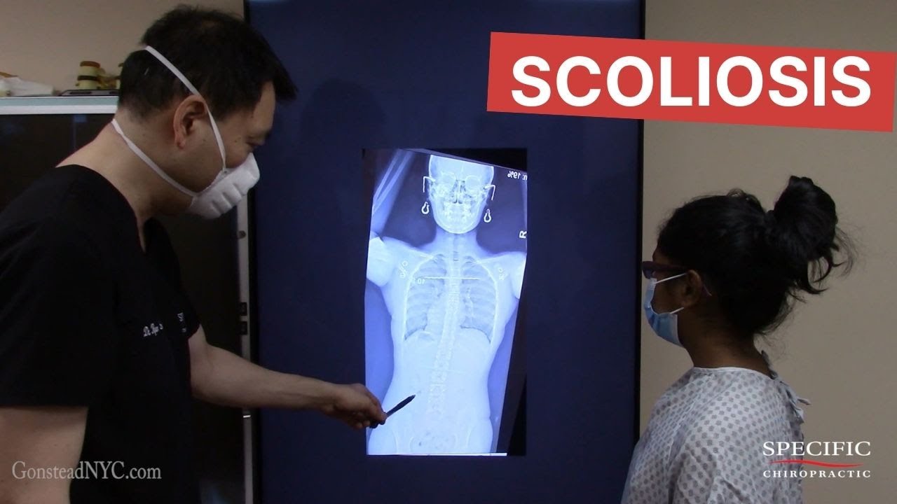 Childhood Scoliosis and Sciatica helped Dr Suh Gonstead Chiropractic NYC