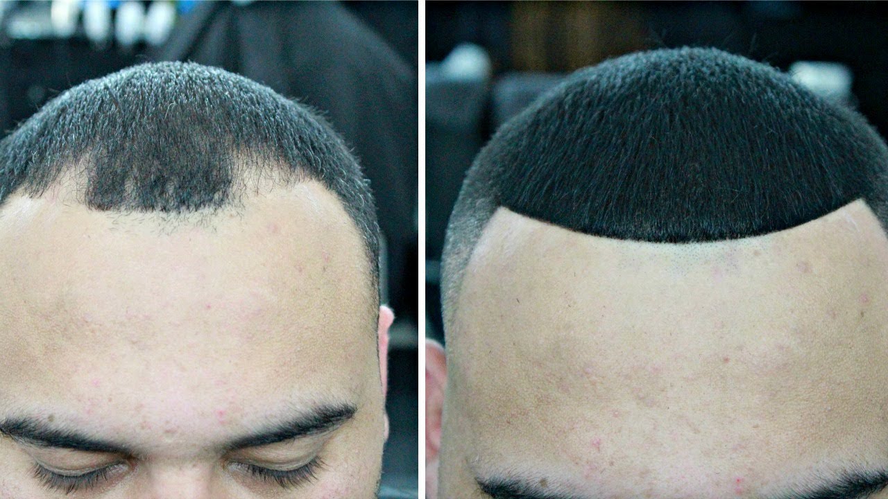 HOW TO COVER UP BALD SPOTS